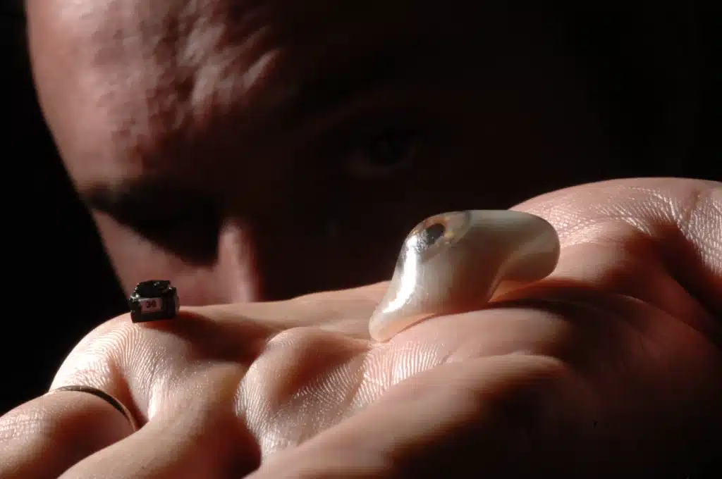 Man explains why replaced his lost eye with wireless camera