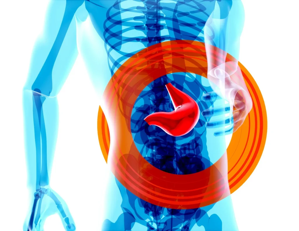 AI is able to spot pancreatic cancer years before a regular diagnosis would happen, study finds