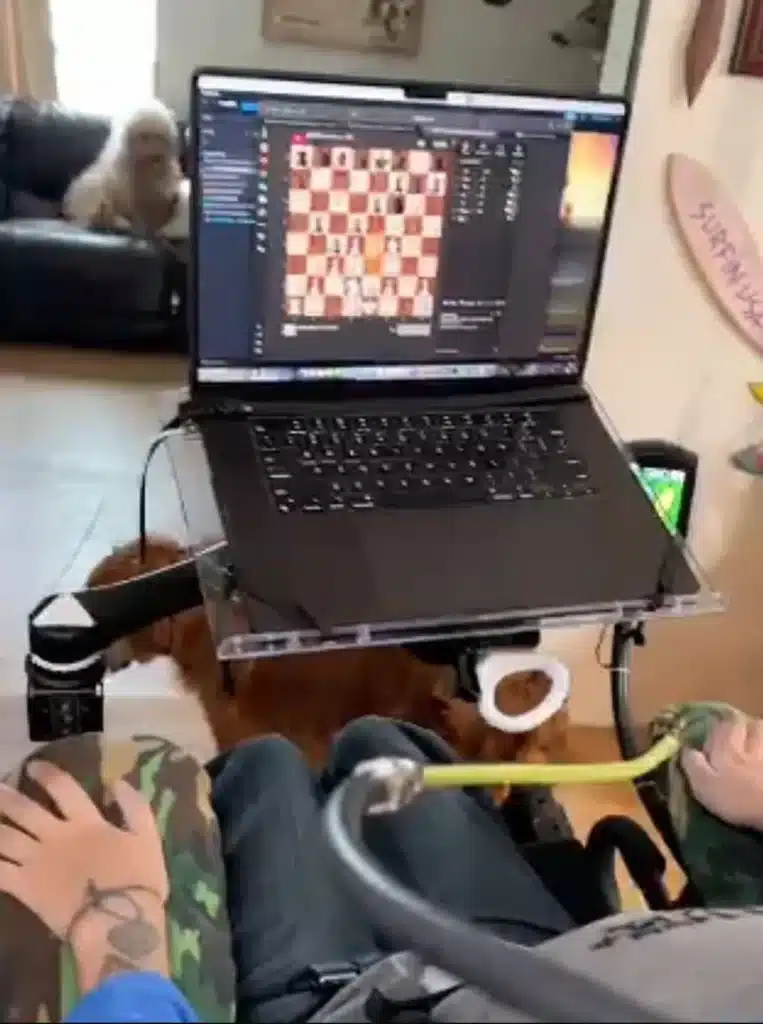 First Neuralink patient shares first post on X using just his thoughts