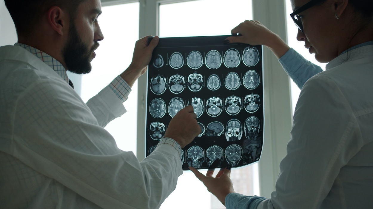 Scientists discover that the human brain is actually two separate organs in groundbreaking new research