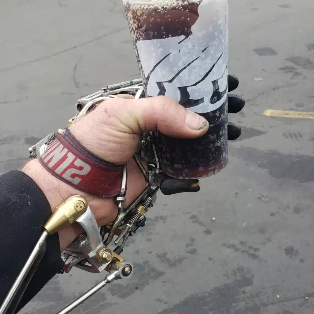 mechanical DIY prosthetic hand ian davis