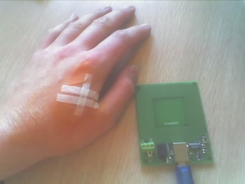 Microchip implants are increasing in popularity in Sweden