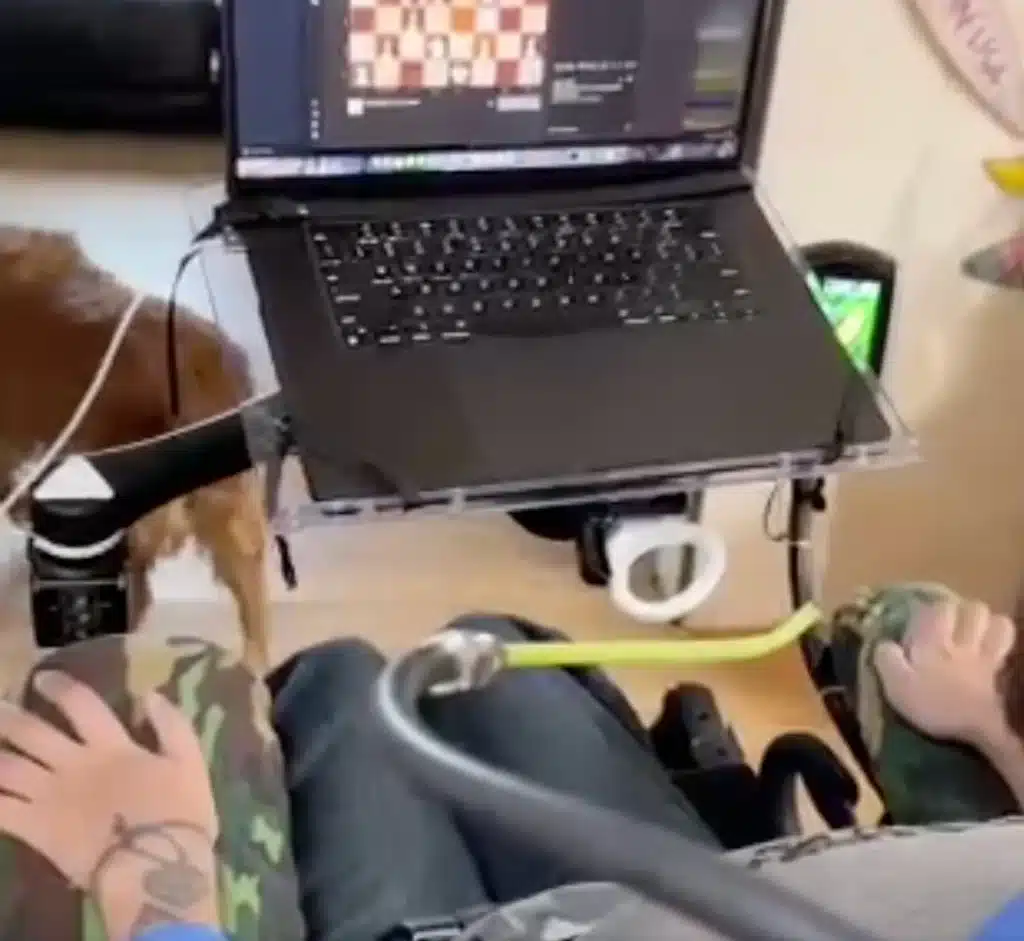 Neuralink patient