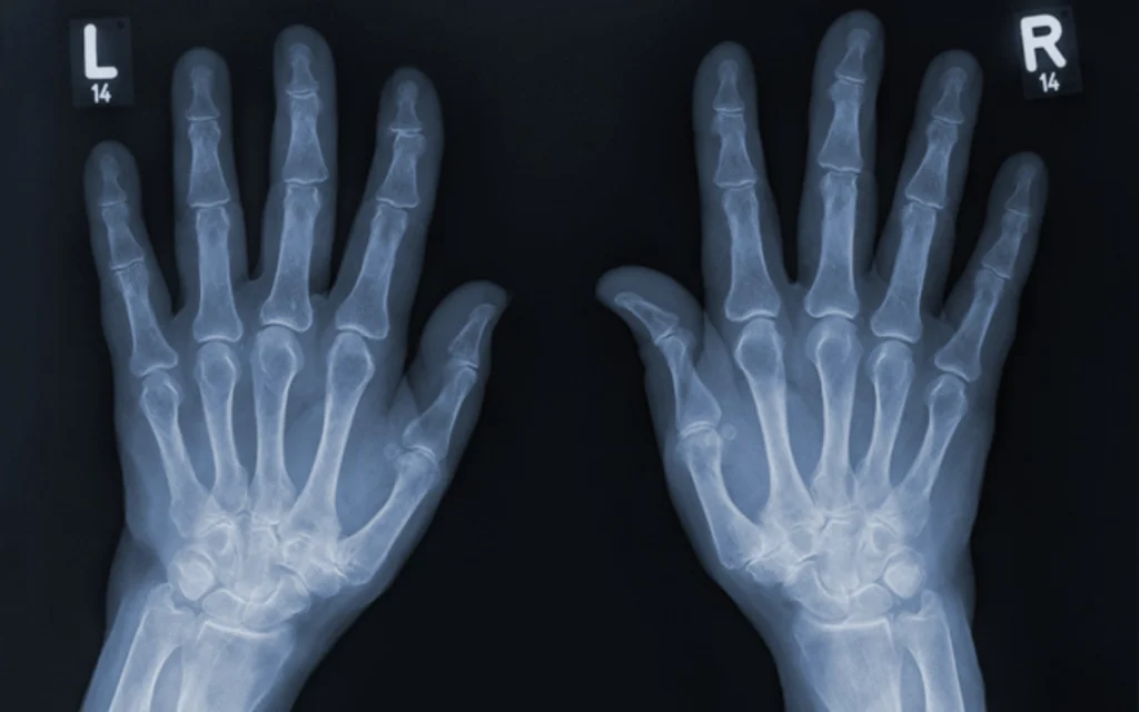 German scientist Wilhelm Conrad Roentgen won the first Nobel Prize in Physics for discovering x-ray technology